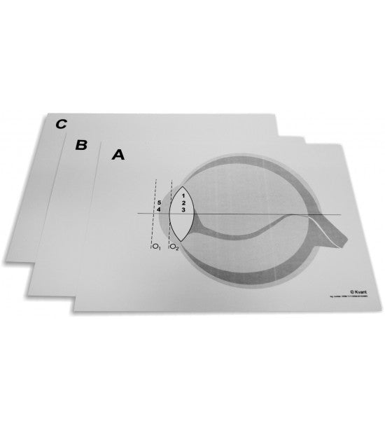 KO4100L - Laser Whiteboard Optics Kit