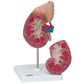 k12 Kidney with Adrenal Gland, 2 part